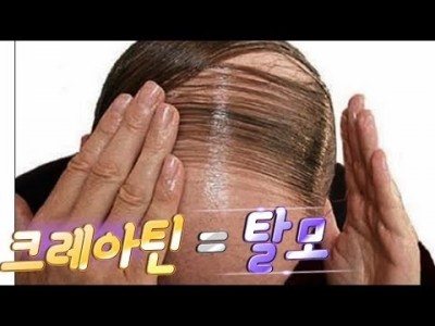 크레아틴 정말 탈모와 연관이 있을까? 스포츠 영양사 동면중님과 함께.