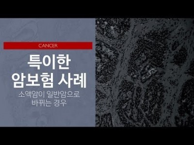 특이한 암보험의 사례: 소액암이 일반암으로 바뀌는 경우
