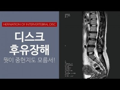 디스크 후유장해: 뭣이 중헌지도 모름서!