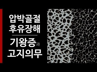 압박골절 후유장해 2 : 기왕증과 고지의무